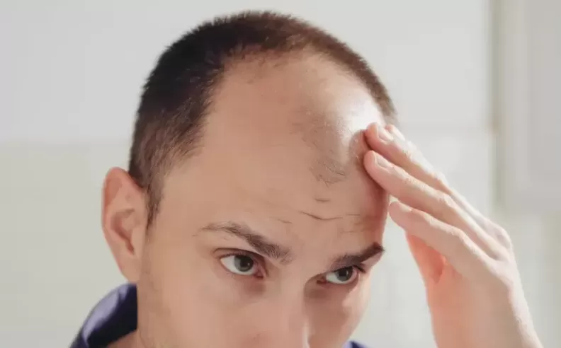 Preventing Hair Loss