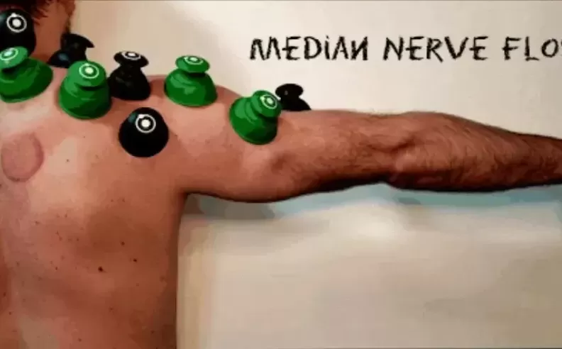 Mobilizing the Median Nerve