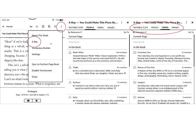 X-Ray Feature for In-Depth Insights
