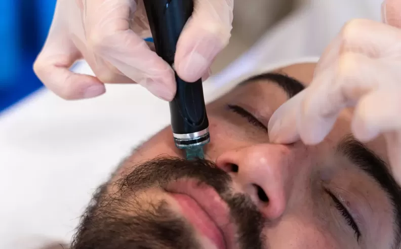 Derma Roller Technology for Collagen Stimulation
