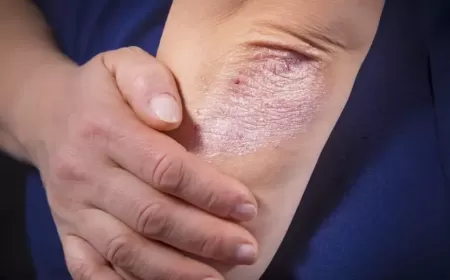 Say Goodbye to Rough Elbows: Easy Fixes Every Guy Can Actually Stick To